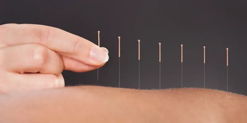 Acupuncture - Life Force Acupuncture