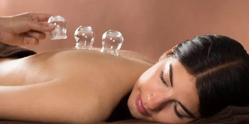 Cupping - Life Force Acupuncture