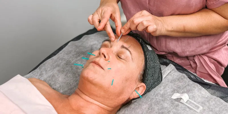 Mini Facial - Life Force Acupuncture